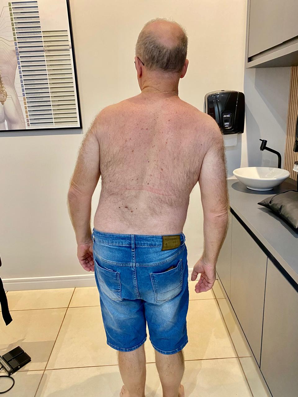 Exemplo paciente antes do atendimento com o Dr. Patrik Paes