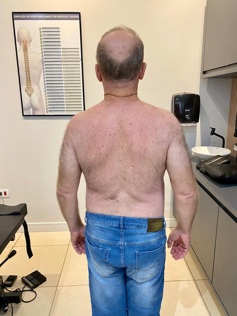 Exemplo paciente depois do atendimento com o Dr. Patrik Paes